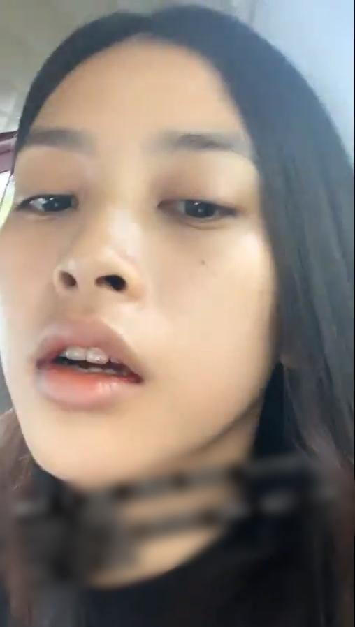 Hoa hậu Tiểu Vy khoe gương mặt sưng húp, mồm còn máu đến khi biết nguyên nhân ai cũng thở phào-2