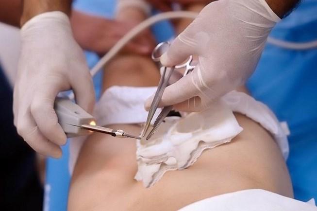 Nam thanh niên bị cần cẩu công trình móc rách tinh hoàn-1