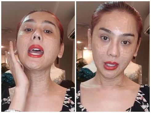 Nói về gương mặt chi chít mụn sần sùi như rắn lột da, Lâm Khánh Chi tự tin: Bản chất tôi đẹp nên không phải sợ-8