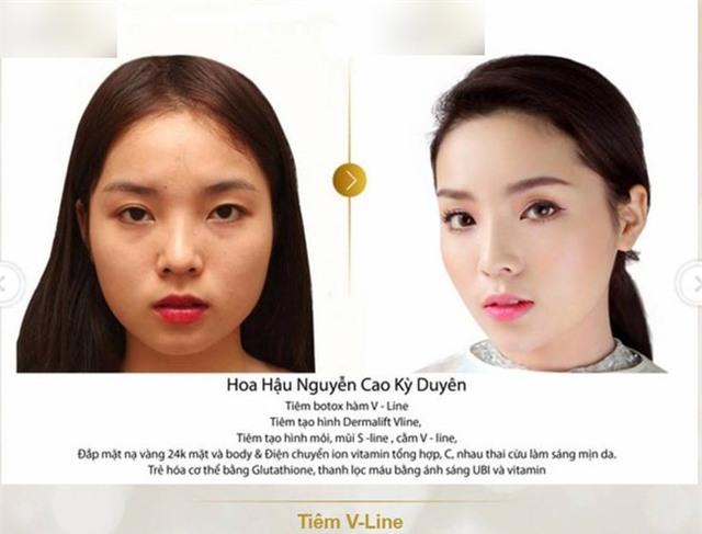 Sau ảnh bán nude, Kỳ Duyên tỉnh bơ trả lời khi được hỏi vì sao đẹp: Vốn dĩ mẹ em sinh ra em đã đẹp sẵn-6