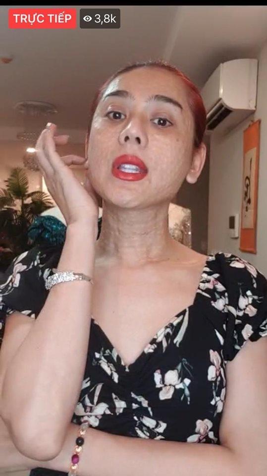 Nói về gương mặt chi chít mụn sần sùi như rắn lột da, Lâm Khánh Chi tự tin: Bản chất tôi đẹp nên không phải sợ-1