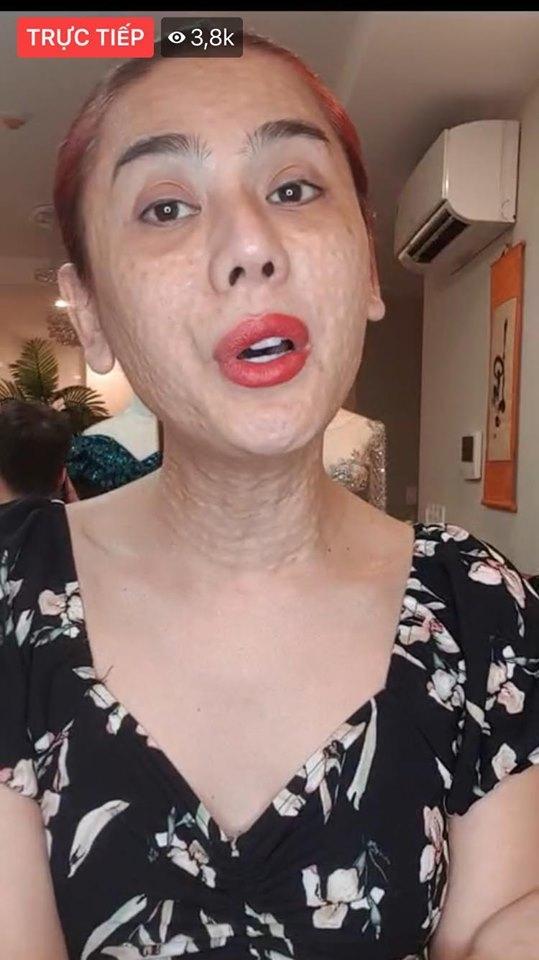 Nói về gương mặt chi chít mụn sần sùi như rắn lột da, Lâm Khánh Chi tự tin: Bản chất tôi đẹp nên không phải sợ-2