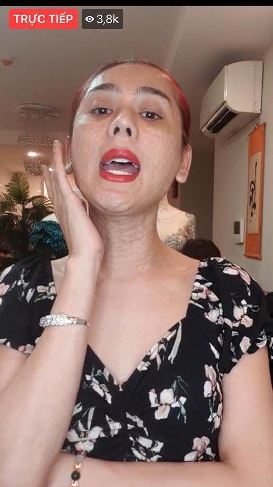 Nói về gương mặt chi chít mụn sần sùi như rắn lột da, Lâm Khánh Chi tự tin: Bản chất tôi đẹp nên không phải sợ-4