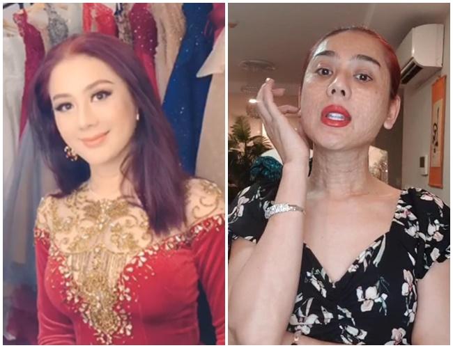 Nói về gương mặt chi chít mụn sần sùi như rắn lột da, Lâm Khánh Chi tự tin: Bản chất tôi đẹp nên không phải sợ-7