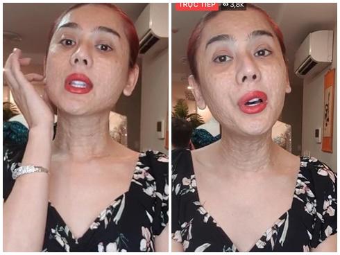 Nói về gương mặt chi chít mụn sần sùi như rắn lột da, Lâm Khánh Chi tự tin: 'Bản chất tôi đẹp nên không phải sợ'