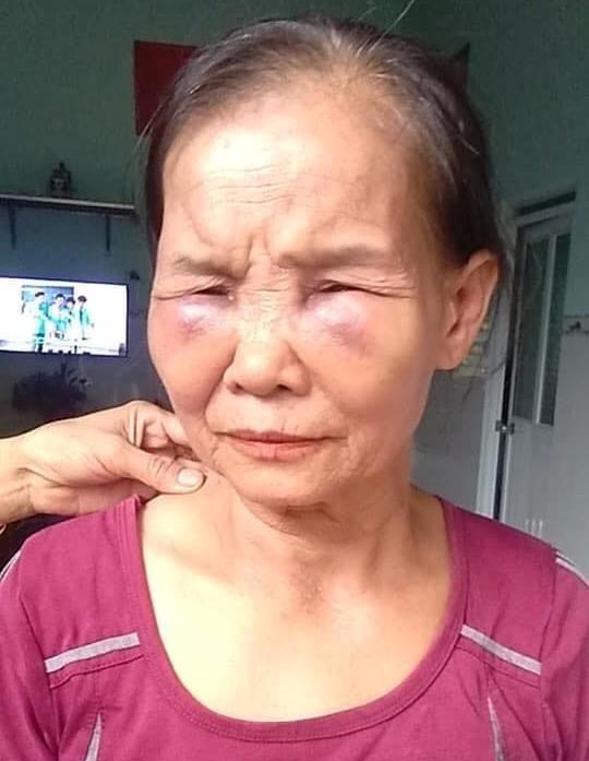 Vụ con dâu đánh mẹ chồng bầm dập mặt mũi: Con dâu bị phạt 2 triệu và tiết lộ ‘mẹ chồng tưới nước đái khắp nhà’-2