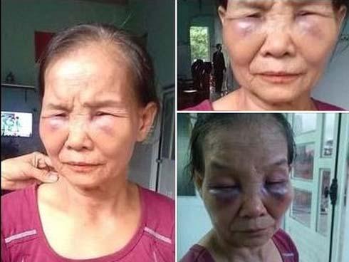 Vụ con dâu đánh mẹ chồng bầm dập mặt mũi: Con dâu bị phạt 2 triệu và tiết lộ ‘mẹ chồng tưới nước đái khắp nhà’-3