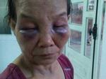 Vụ con dâu đánh mẹ chồng bầm dập mặt mũi: Con dâu bị phạt 2 triệu và tiết lộ ‘mẹ chồng tưới nước đái khắp nhà’
