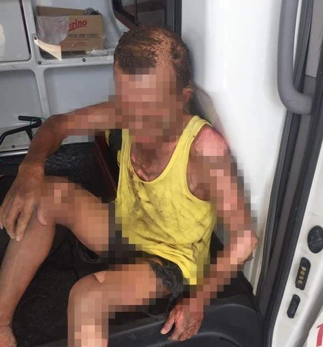 Nam Định: Con trai tưới xăng châm lửa đốt khiến bản thân tử vong, bố nhập viện cấp cứu-1