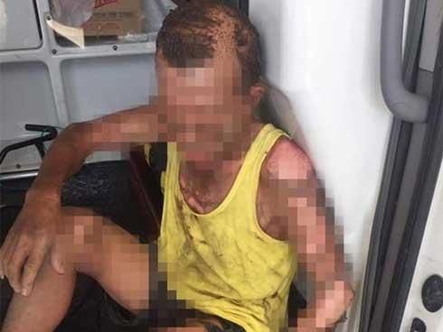 Nam Định: Con trai tưới xăng châm lửa đốt khiến bản thân tử vong, bố nhập viện cấp cứu