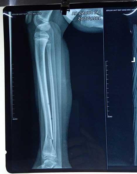 Clip: Xe điên húc 2 người đi xe máy bay như chim trên đường ở Thái Nguyên-1