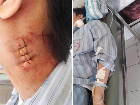 Bị ô tô gây tai nạn bỏ mặc, nữ lao công viết rõ biển số trước khi tử vong-3