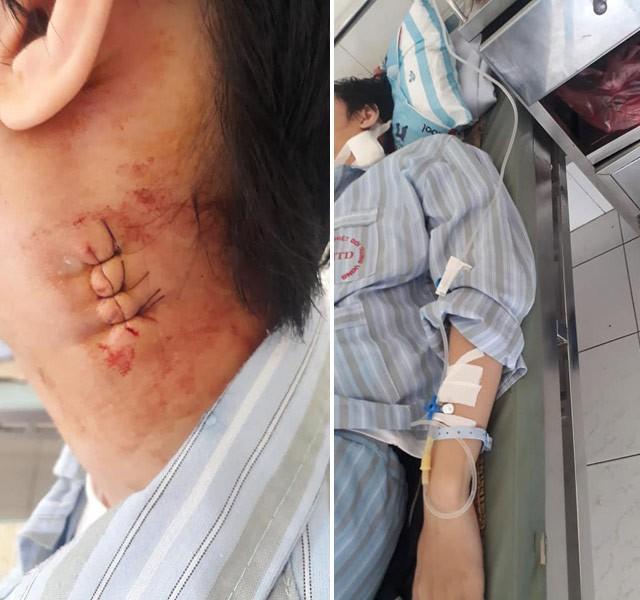Người mẹ phẫn uất tố bác sĩ Bệnh viên Bạch Mai MỔ NHẦM khiến con bị cứng cổ, không nói được-2