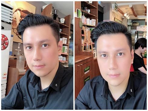 Việt Anh công khai dung mạo sau phẫu thuật thẩm mỹ, dân mạng kêu trời vì 'giống hệt Lương Bằng Quang'