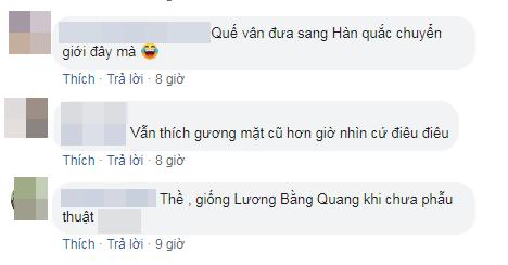 Việt Anh bị chê phẫu thuật thẩm mỹ lỗi, Quế Vân bênh ra mặt: Chờ 15 ngày nữa rồi hãy nhận xét-5