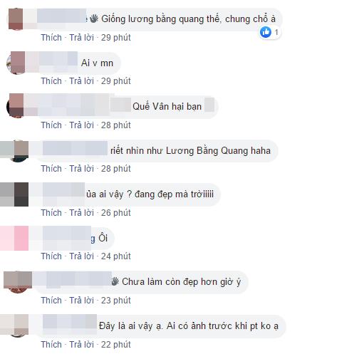 Việt Anh bị chê phẫu thuật thẩm mỹ lỗi, Quế Vân bênh ra mặt: Chờ 15 ngày nữa rồi hãy nhận xét-7