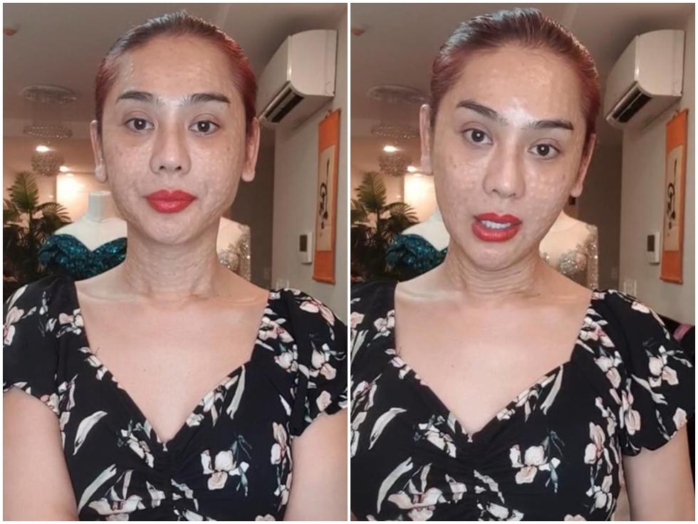 Vừa gây sốc với gương mặt như rắn lột da, Lâm Khánh Chi vẫn tự tin: Em cứ xinh đẹp bất chấp dòng đời xuôi ngược-1