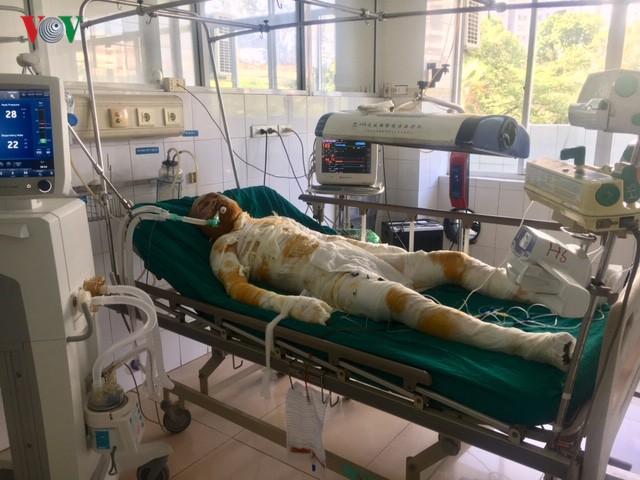 Vụ đốt nhà làm 5 người thương vong: Các nạn nhân đang nguy kịch-1