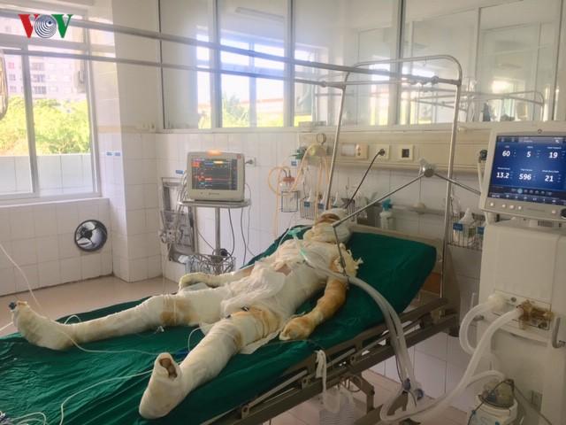 Vụ đốt nhà làm 5 người thương vong: Các nạn nhân đang nguy kịch-2