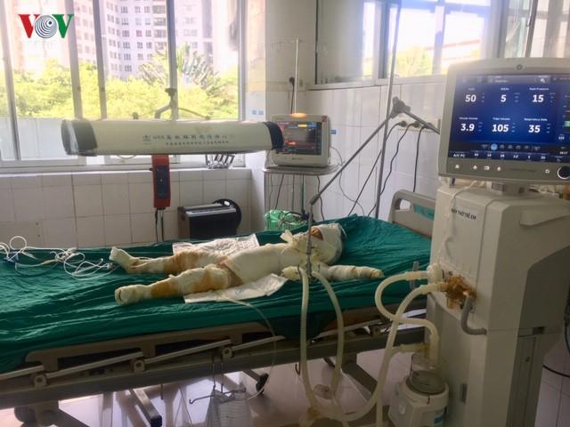 Vụ đốt nhà làm 5 người thương vong: Các nạn nhân đang nguy kịch-4