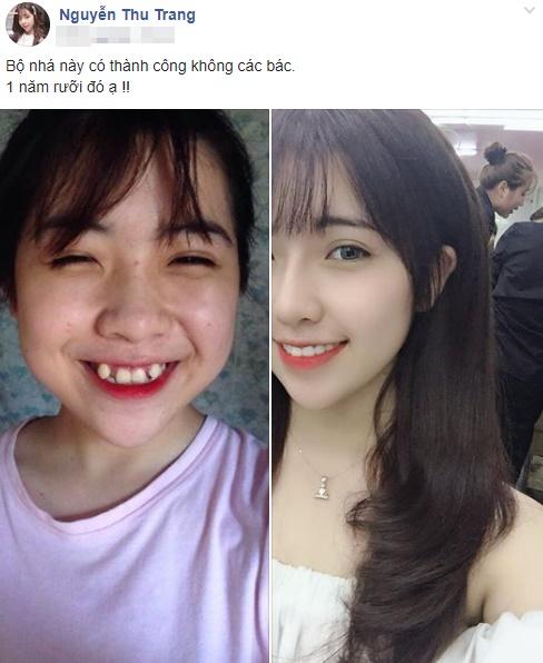 Khoe bộ nhá cũng dậy thì thành công, cô gái làm dân tình chao đảo khi khuyến mãi thêm gương mặt xinh đẹp nhờ công nghệ-1