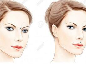 5 nốt ruồi được cho là khắc chồng, lăng nhăng, dễ ngoại tình, nhất định phải xóa 5 nốt ruồi được cho là khắc chồng, lăng nhăng, dễ ngoại tình, nhất định phải xóa