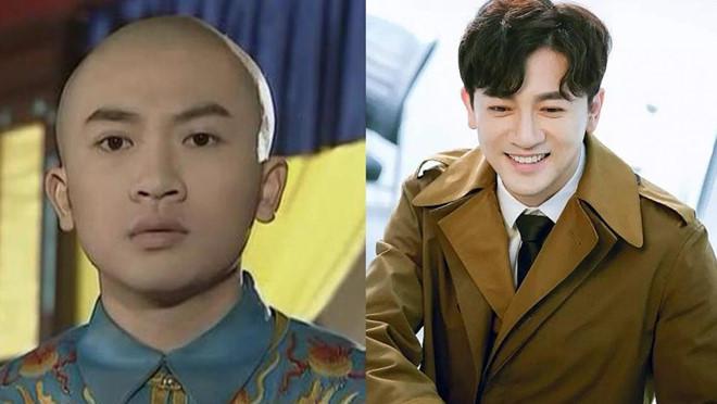 Sao nam thay đổi như thế nào sau khi đụng chạm dao kéo?-7