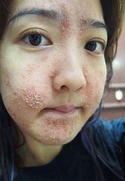 Thánh kem trộn bán kem trắng da từ dung dịch vệ sinh phụ nữ bị cơ quan chức năng sờ gáy-7