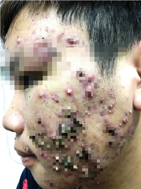 Thánh kem trộn bán kem trắng da từ dung dịch vệ sinh phụ nữ bị cơ quan chức năng sờ gáy-8