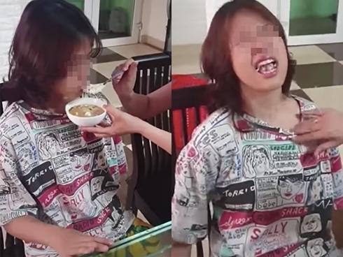 Cô gái sống trong cũi như trẻ sơ sinh, tốn 7 triệu đồng tiền bỉm mỗi tháng-5