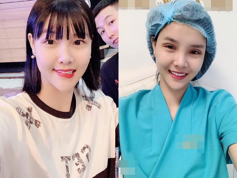 Bất chấp sự phản đối của Mạc Hồng Quân, Kỳ Hân công khai phẫu thuật thẩm mỹ lần thứ n với gương mặt sưng phù khó nhận diện-5