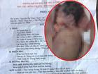 Câu chuyện cuối tuần: Bản tường trình viết tay hé lộ tình tiết ghê rợn việc bác sĩ kéo đứt lìa đầu thai nhi ở Hà Tĩnh