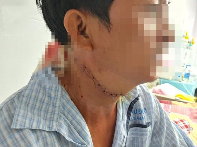 Nóng: Bắt giữ nghi phạm cứa cổ tài xế xe ôm công nghệ ở TP. HCM-2