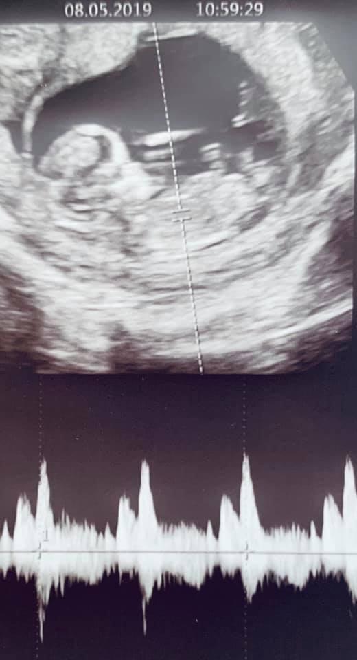 Lan Khuê khoe bụng bầu lớn lên trông thấy, ông xã đại gia nịnh vợ không thể ngọt ngào hơn-5