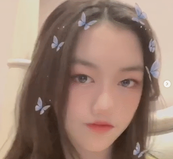 Con gái hở hàm ếch của Lý Á Bằng tự tin khoe ngoại hình sau ca phẫu thuật-1