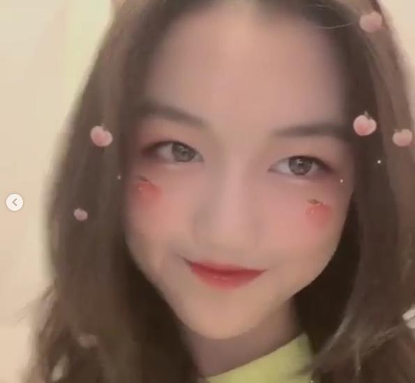 Con gái hở hàm ếch của Lý Á Bằng tự tin khoe ngoại hình sau ca phẫu thuật-2