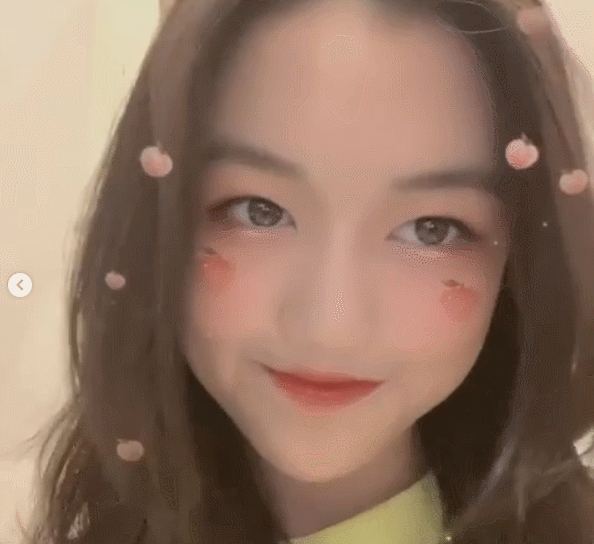 Con gái hở hàm ếch của Lý Á Bằng tự tin khoe ngoại hình sau ca phẫu thuật-3