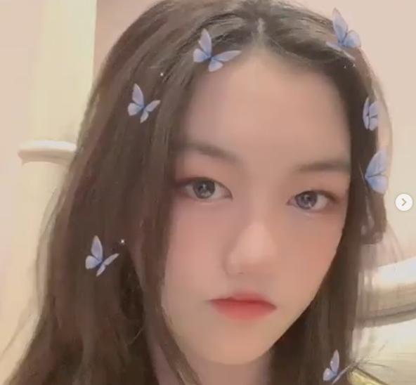 Con gái hở hàm ếch của Lý Á Bằng tự tin khoe ngoại hình sau ca phẫu thuật-5