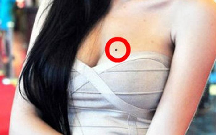 3 nốt ruồi phú quý của phụ nữ báo hiệu người ngồi không cũng giàu có, nằm ở đâu?-2