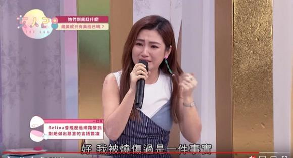 Nữ ca sĩ Đài Loan nức nở khi bị miệt thị vóc dáng sau tai nạn bỏng-1