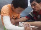 Bé 13 tuổi ở Quảng Nam bị thanh niên chở vào rừng đánh gãy tay, cướp 1,2 triệu