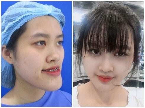 Muốn cuộc sống dễ dàng, giới trẻ Trung Quốc đua nhau đi thẩm mỹ-4