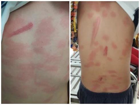 Cô ruột đánh cháu dã man: 'Má nhìn nó liếc con kìa'