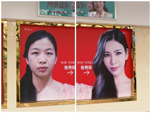 Muốn 'cuộc sống dễ dàng', giới trẻ Trung Quốc đua nhau đi thẩm mỹ