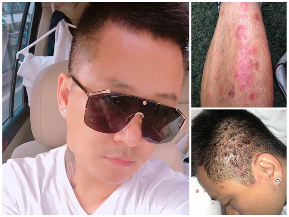 Bị thầy lang lợi dụng hình ảnh quảng cáo bệnh vảy nến, Tuấn Hưng quát tháo: Đồ dơ dáy, mất nhân tính-1