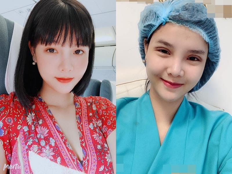 Tưởng cắt chỉ thẩm mỹ xong sẽ xinh đẹp hơn, ai dè gương mặt Kỳ Hân lại bị chê đơ như cây cơ-3