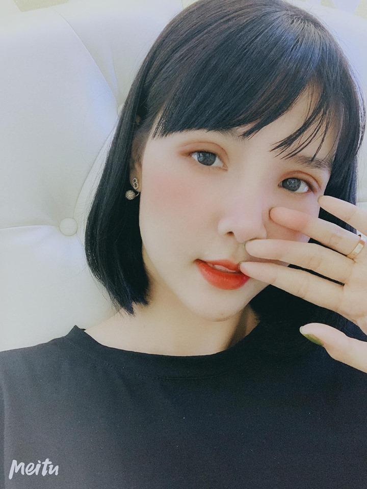 Tưởng cắt chỉ thẩm mỹ xong sẽ xinh đẹp hơn, ai dè gương mặt Kỳ Hân lại bị chê đơ như cây cơ-5