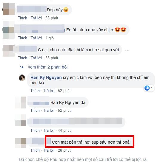 Tưởng cắt chỉ thẩm mỹ xong sẽ xinh đẹp hơn, ai dè gương mặt Kỳ Hân lại bị chê đơ như cây cơ-7