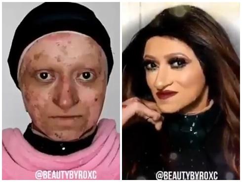 SỨC MẠNH VI DIỆU CỦA MAKE-UP: Biến cô gái mặt bỏng nặng hóa thành nữ diva sang chảnh