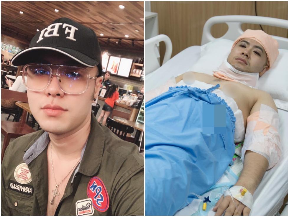 Akira Phan giảm show, bị chê phát tướng trước khi hút mỡ toàn thân-1